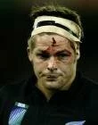 Richie McCaw: Battered
